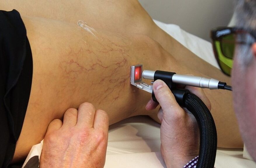 Promieniowanie laserowe