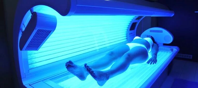Żylaki i solarium